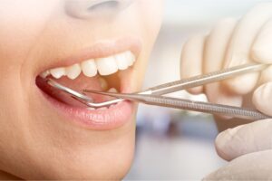 kansas city periodontal care